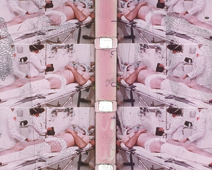 Color slide from 35mm film of repeated image of man in medical setting on a gurney with a bandaged leg and head being attended to by two individuals in white coats